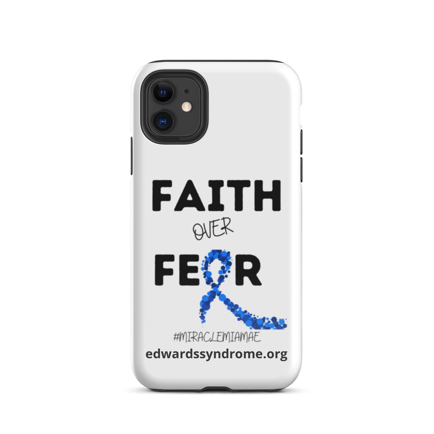 Edwards Syndrome Faith over fear iphone case